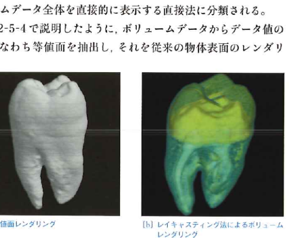 ヒトの歯のCTデータのボリュームビジュアライゼーション